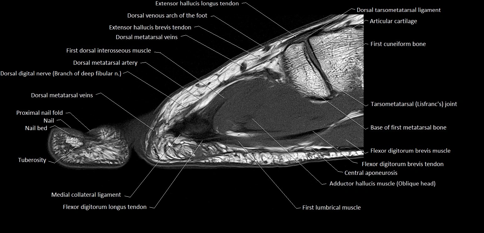 Hallux or big toe sagittal anatomy 3T MRI image 19.webp
